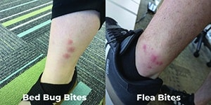 Bed Bug Bites vs Flea Bites On Ankles