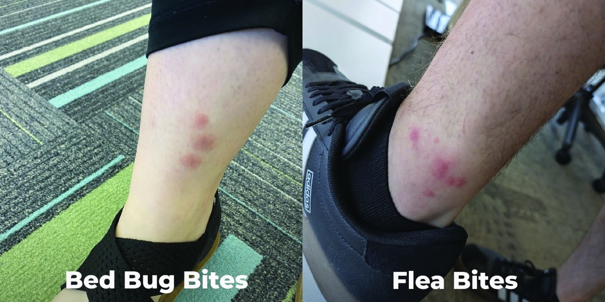 Bed Bug Bites vs Other Insects