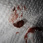 Squashed Bed Bug Blood